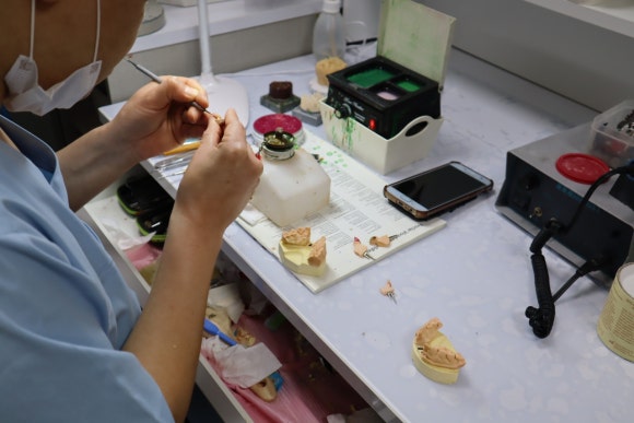 Where Can I Get Good Dental Laminates in Gangnam? image 12