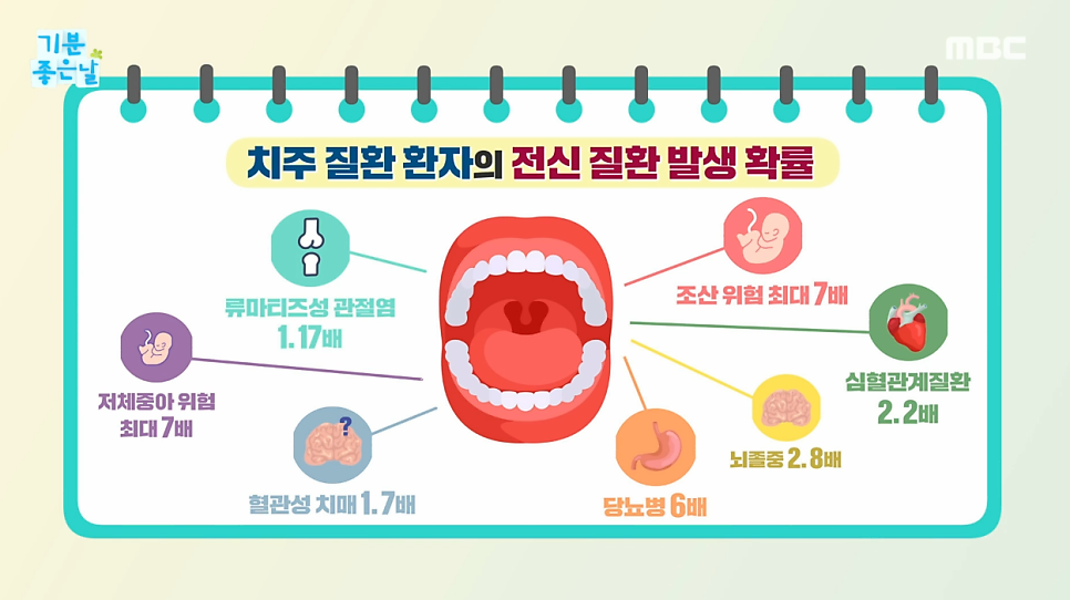 MBC기분좋은날 출연, 신사역 더스타치과 하현 대표원장님 관련 이미지 3