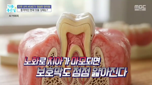 강남 잇몸재건술, 뼈이식 치료가 필요한 경우, 방법 정리해드립니다 관련 이미지 3