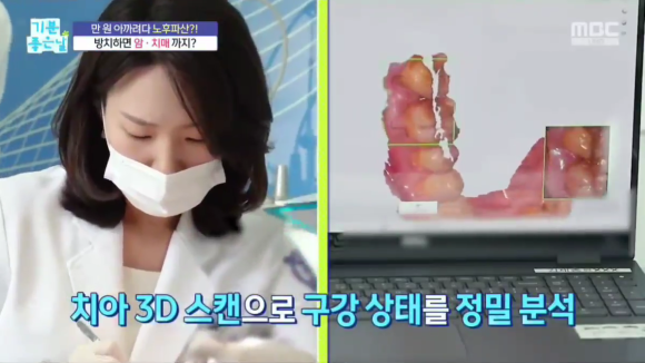 강남 잇몸재건술, 뼈이식 치료가 필요한 경우, 방법 정리해드립니다 관련 이미지 4