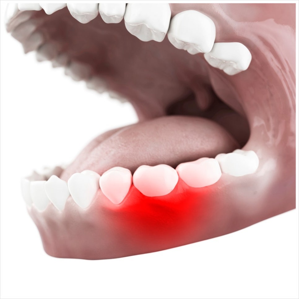 서울임플란트치과 선택의 기준, 더스타치과가 전하는 비용너머의 이야기 관련 이미지 6
