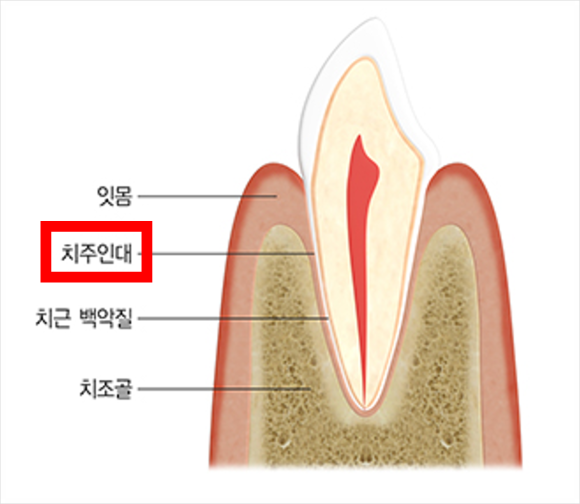 강남 자연치아 보존치료 치과 | 발치 권유받은 치아를 다시 살리는 것에 대해 관련 이미지 5