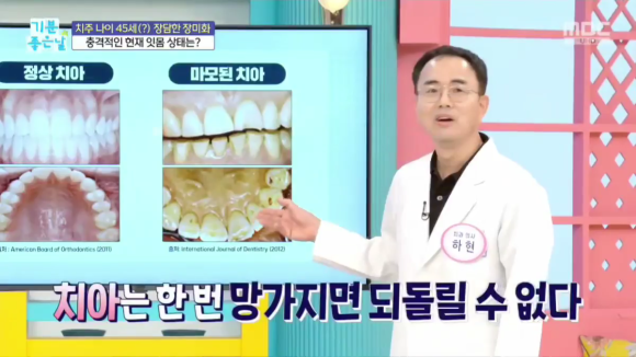 강남 잇몸재건술, 뼈이식 치료가 필요한 경우, 방법 정리해드립니다 관련 이미지 1