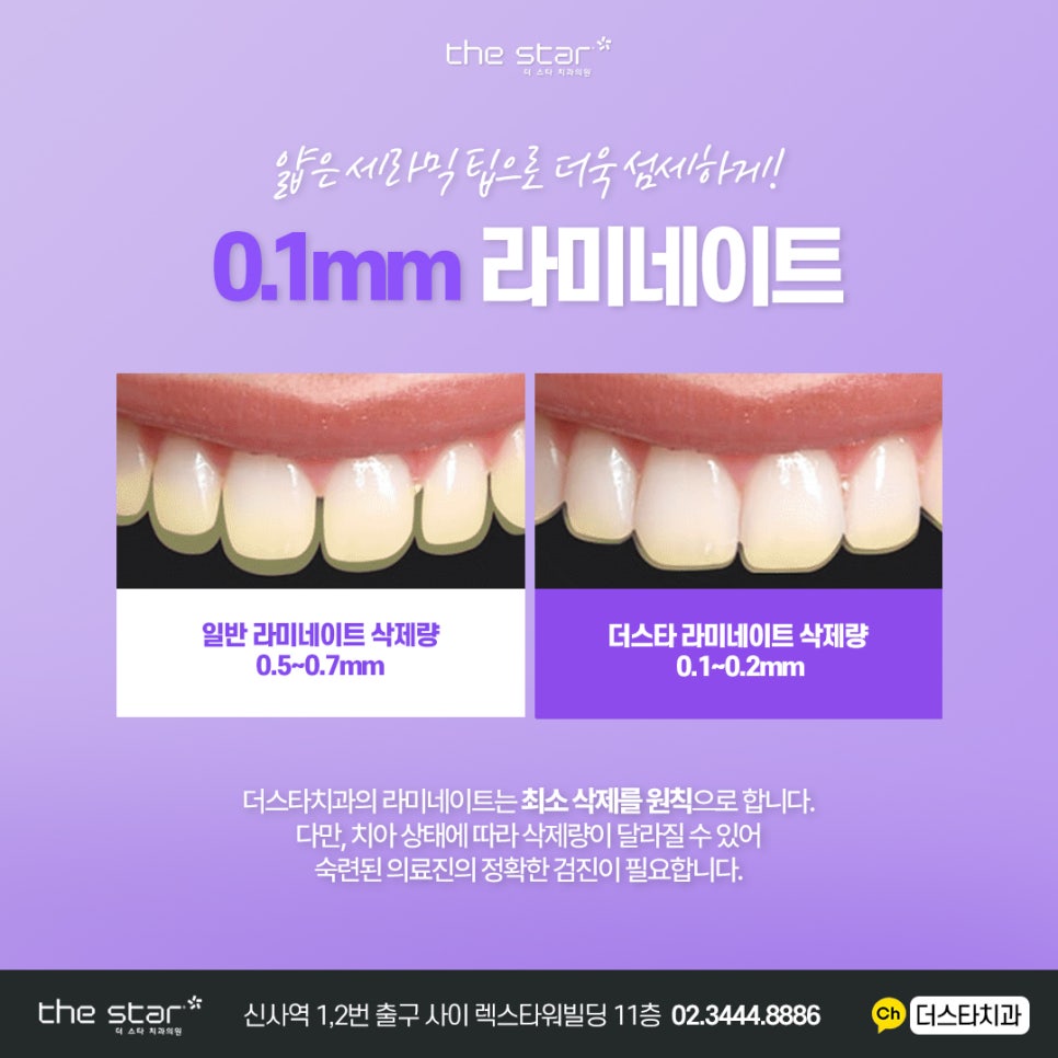 신사동 프리미엄 라미네이트 디테일 치료 과정 고민이시라면 더스타치과로 관련 이미지 13