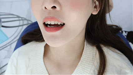 Where Can I Get Good Dental Laminates in Gangnam? image 7