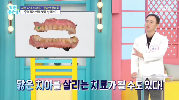 강남 라미네이트 치과추천, 마모된 치아 기능 살리는 심미보철치료 관련 이미지 4
