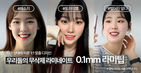 Where Can I Get Good Dental Laminates in Gangnam? image 13