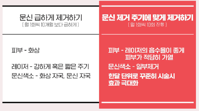 [서울대입구피부과] 깔끔하고 빠른 문신제거를 원한다면? 피코레이저! 관련 이미지 6