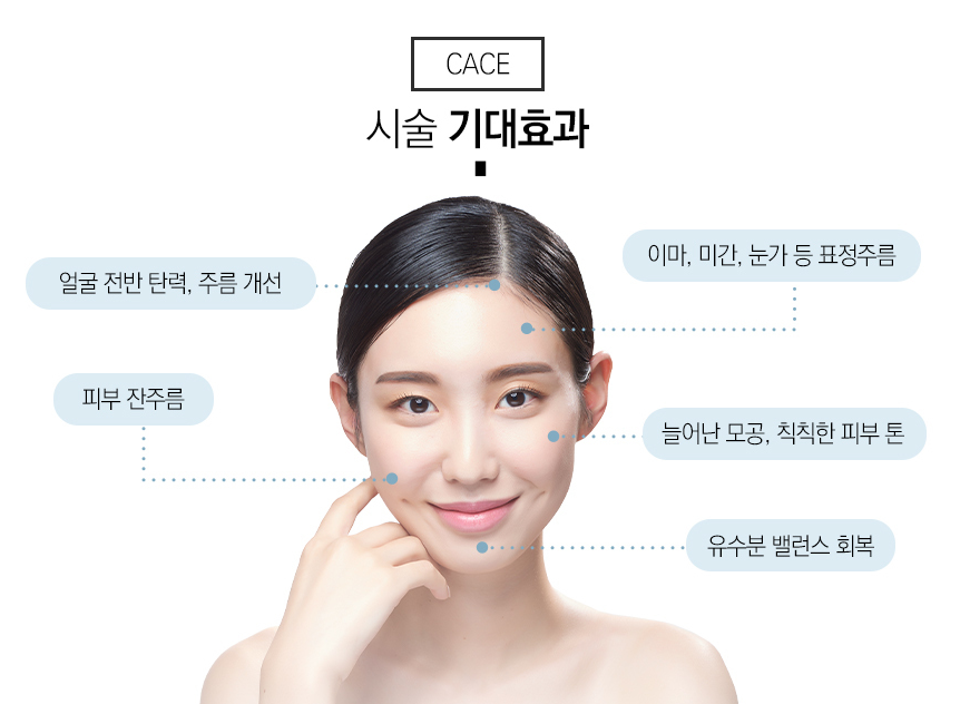 관악구리쥬란 장점을 고스란히 피부에 관련 이미지 5