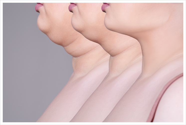 Why Neck Wrinkles Reveal Your Age Before Your Face Does image 1