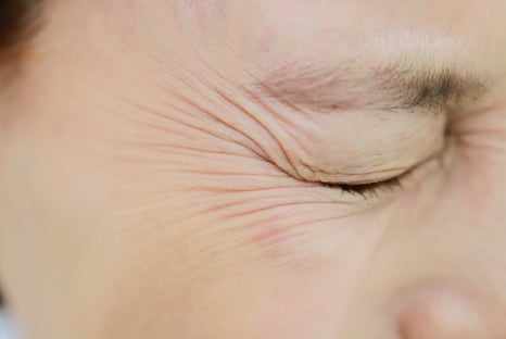 나이가 들면서 생기는 주름 중 가장 신경 쓰이는 부위는? 팔자주름 없애기 관련 이미지 6