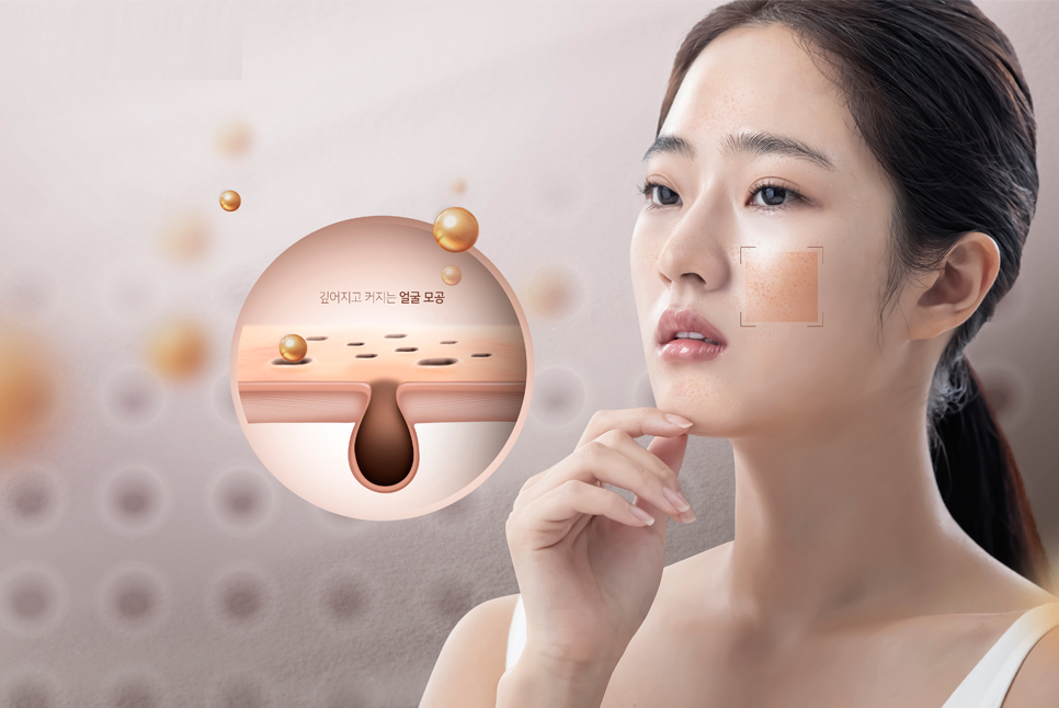 넓어진 모공 축소 및 줄이는 방법에 효과 좋은 치료는? 관련 이미지 7