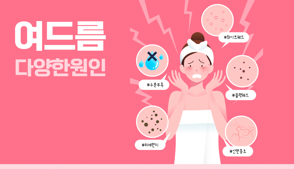 아그네스레이저 여드름치료 하세요 관련 이미지 2
