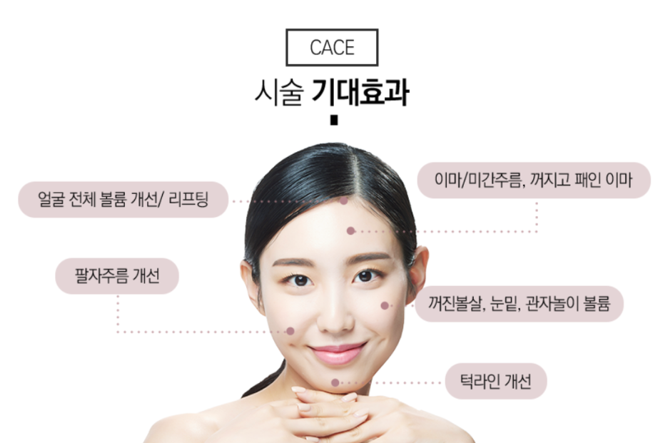 스컬트라효과 유지기간도 체크하세요 관련 이미지 6
