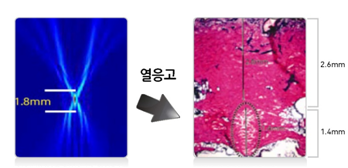 볼살 안빠지게 쉬링크 하는 법, 슈링크와 에어젯 관련 이미지 1