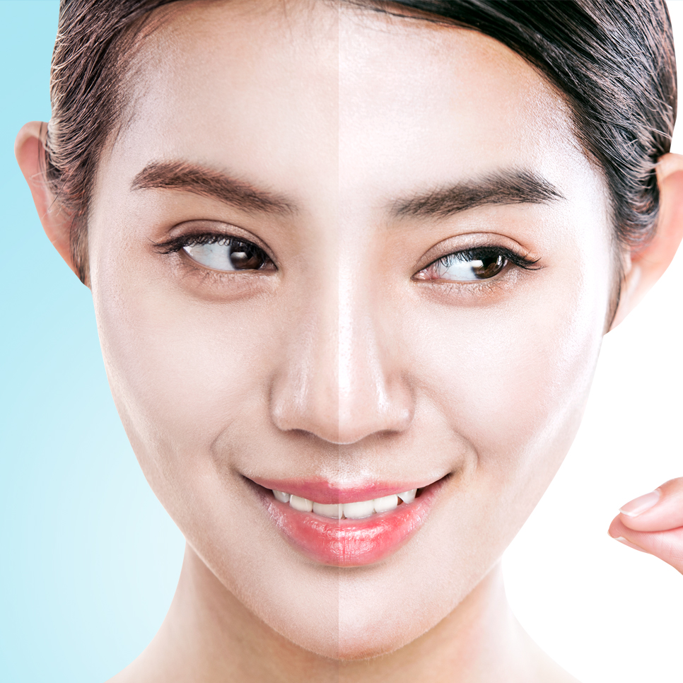 아쿠아필 서울대입구역피부과에서 만나보세요 관련 이미지 1