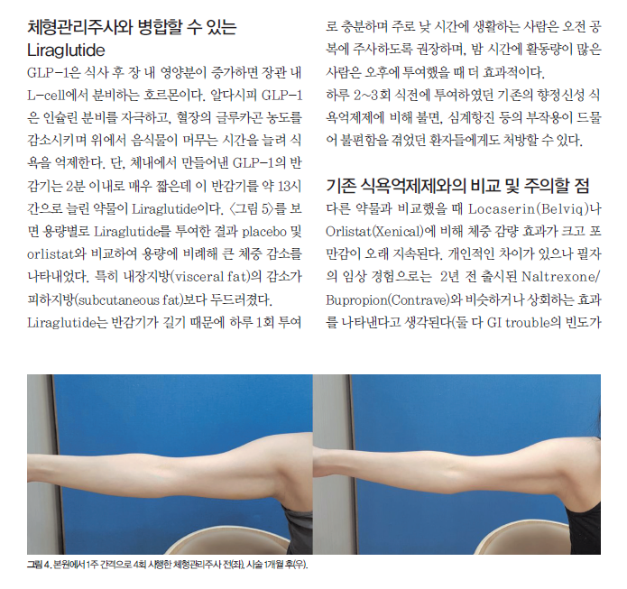삭센다, 많이 쓰는 병원이다 보니... 관련 이미지 6