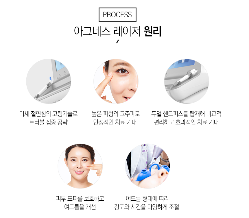 서울대입구아그네스 여드름만 타겟 관련 이미지 6