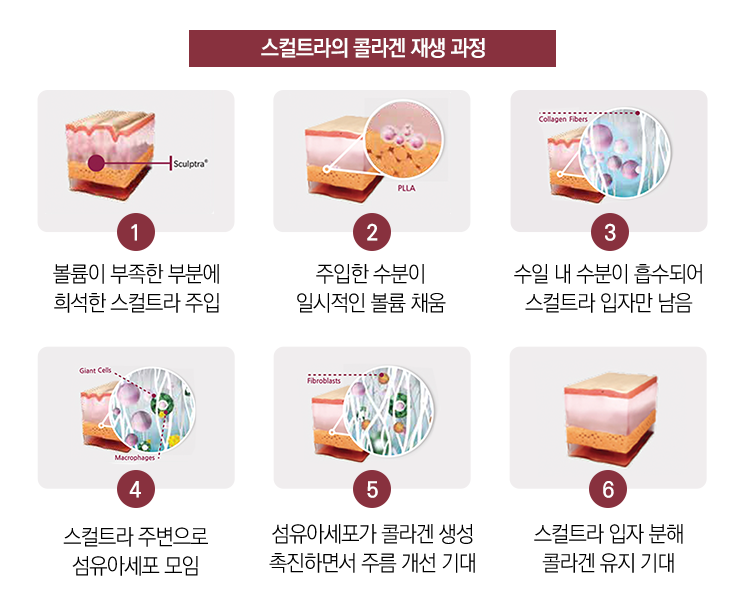 시간이 지날수록 차오르는 볼륨! 사당동스컬트라 관련 이미지 4
