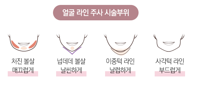 서울대입구보톡스 얼굴라인주사로 라인잡기 관련 이미지 3