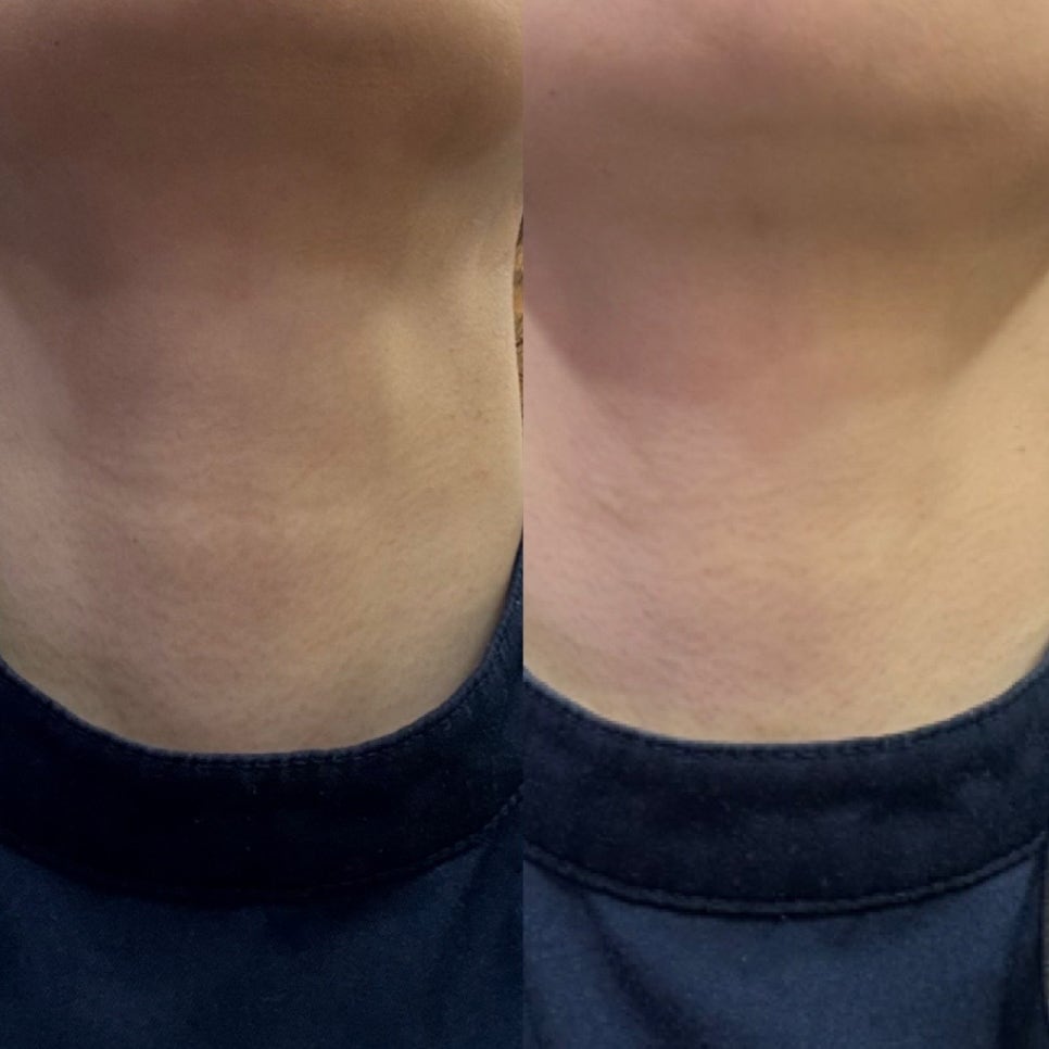 저도 이제 목주름이 생기네요??(전원장 목주름극뽁 프로젝트) 관련 이미지 7