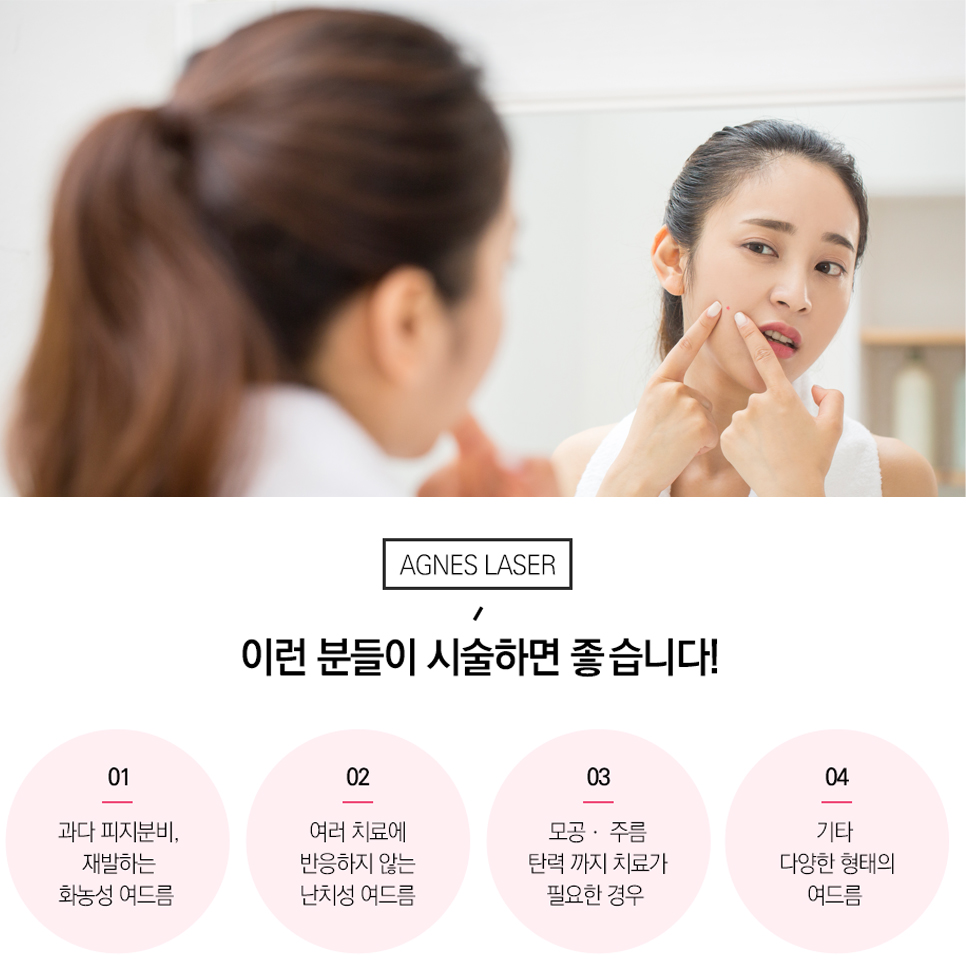 여드름 눈 밑 한관종 비립종 깨끗하게 없애는 법 아그네스 레이저 관련 이미지 2