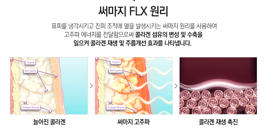 서울대입구써마지 보존적 리프팅을 원한다면 관련 이미지 5