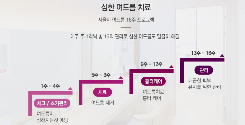여드름 없애는법! 알아보고 케어하는 것이 중요 관련 이미지 4