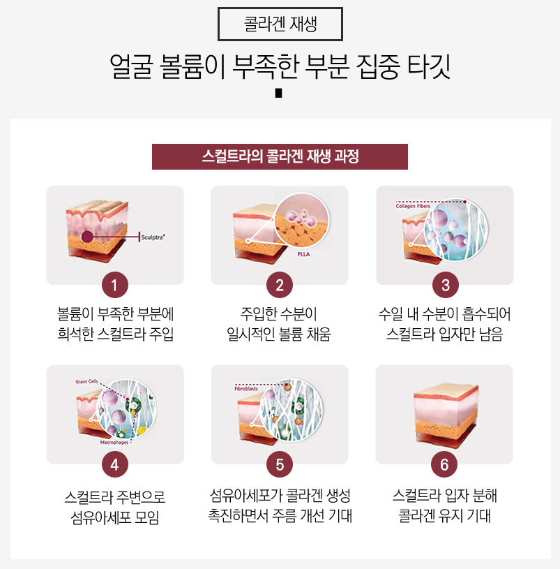 낙성대스컬트라로 자연스럽게 오래가는 볼륨! 관련 이미지 6