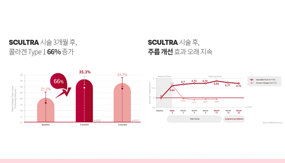 눈밑꺼짐 옆볼꺼짐 관련 이미지 4