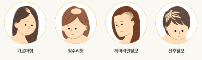 사당동피부과 만족도 높은 탈모테라피 관련 이미지 1