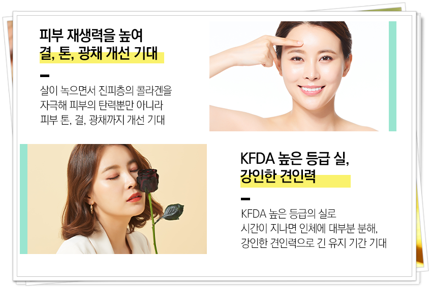 서울대입구역실리프팅 노화는 미루자 관련 이미지 6