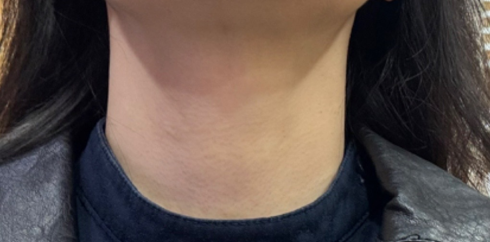 저도 이제 목주름이 생기네요??(전원장 목주름극뽁 프로젝트) 관련 이미지 6
