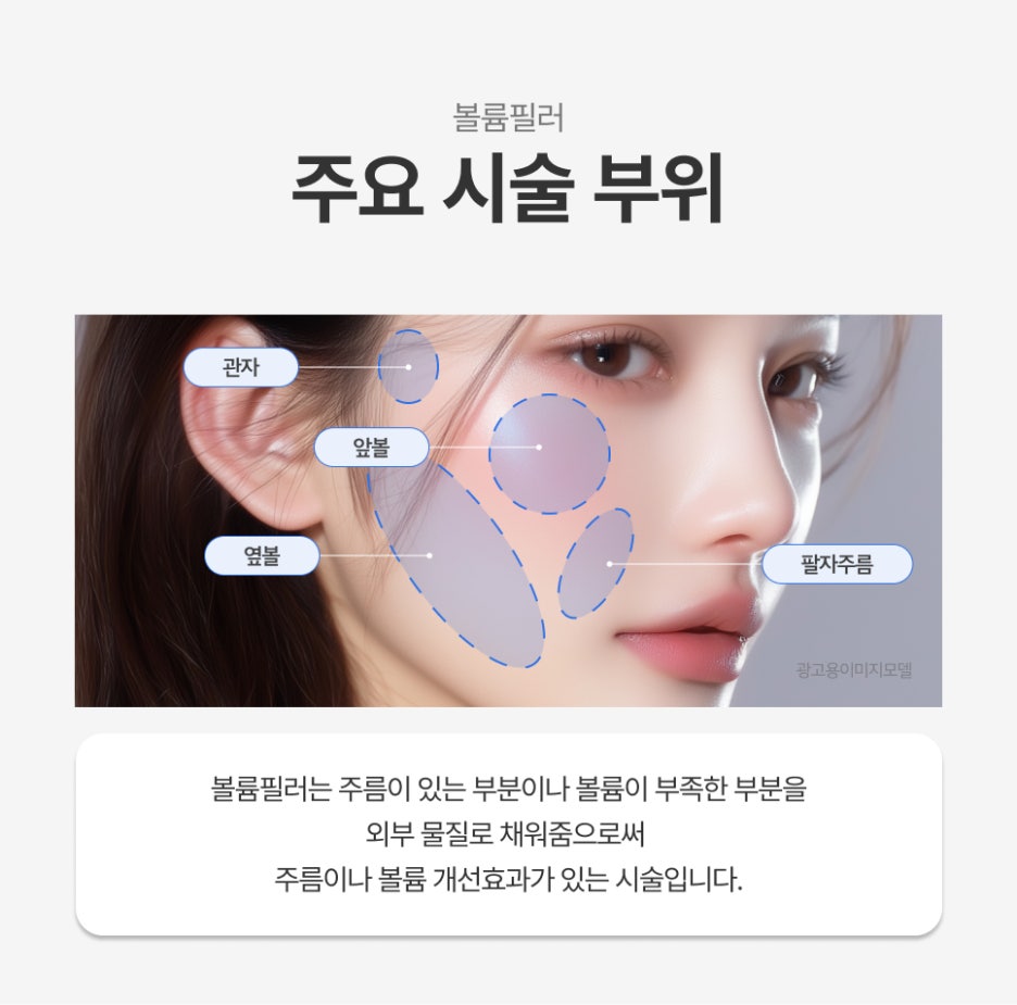 What Makes the Same 1 cc of Nasolabial Fold Filler Look Different at Samseong Station image 4