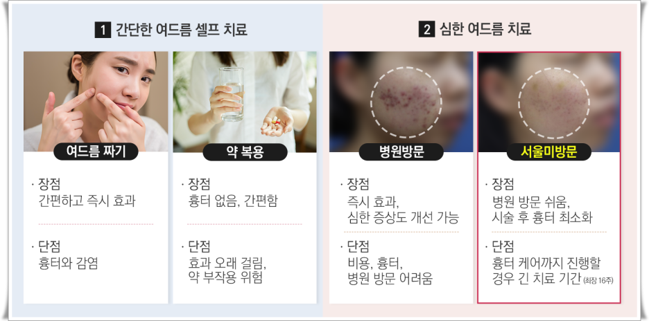 여드름스케일링 의료진과 함께 관련 이미지 2