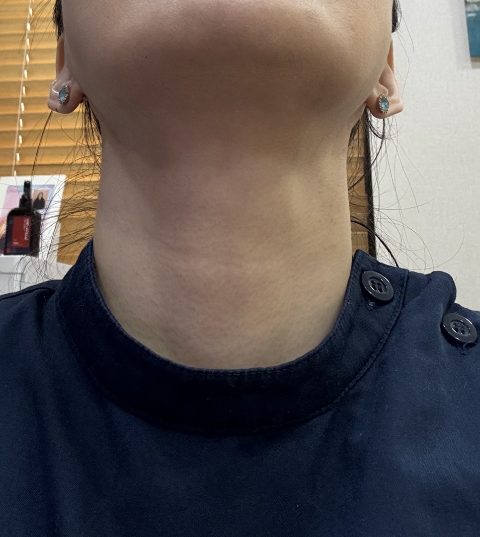 저도 이제 목주름이 생기네요??(전원장 목주름극뽁 프로젝트) 관련 이미지 1
