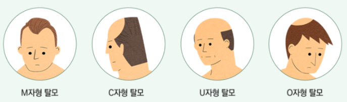 사당동피부과 만족도 높은 탈모테라피 관련 이미지 2