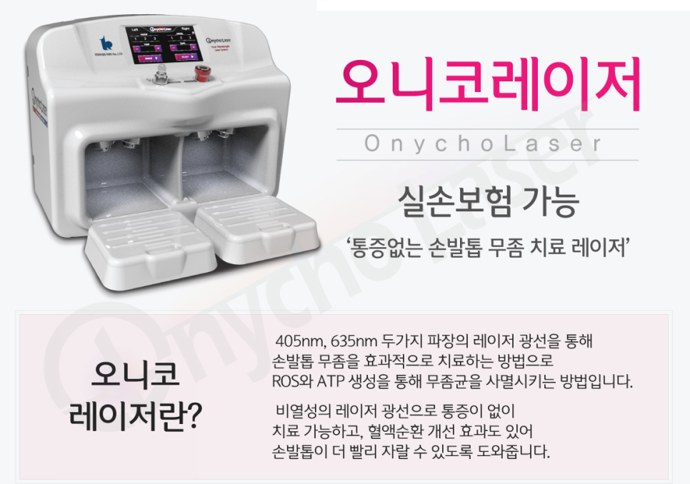관악구 발톱무좀레이저-오니코레이저로 무좀안녕 관련 이미지 2