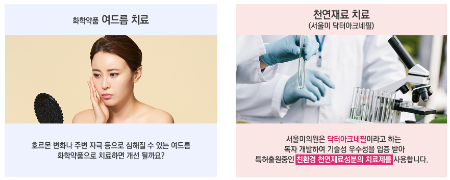 여드름에 직빵!! 여드름 자국 및 흉터 개선에 효과적인 스케일링 케어 관련 이미지 8