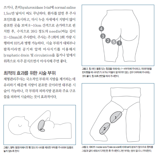 삭센다, 많이 쓰는 병원이다 보니... 관련 이미지 5