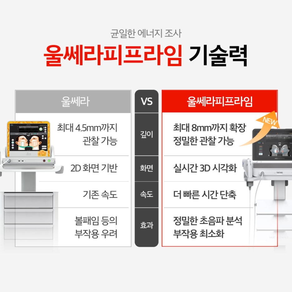 Are You Putting Off Ultherapy PRIME Because You’re Worried About Cheek Hollowing? Toxnfill Samsung Branch near COEX image 3