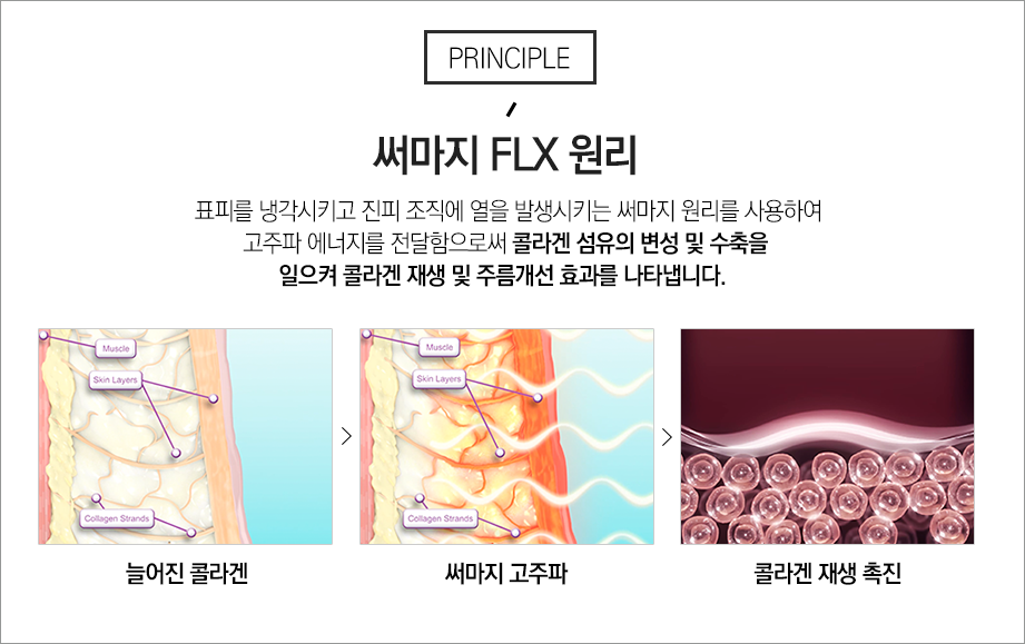 서울대입구역피부과 맞춤 탄력 케어는 방법 관련 이미지 10
