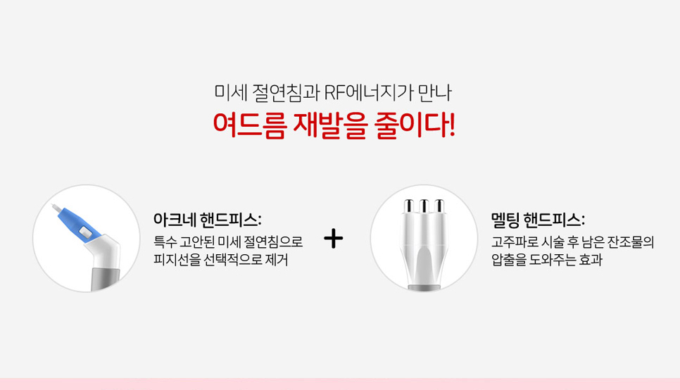 아그네스레이저 여드름치료 하세요 관련 이미지 5