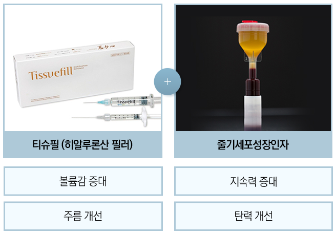 볼륨감과 탄력을 한 번에? 봉천동필러 큐오필! 관련 이미지 3