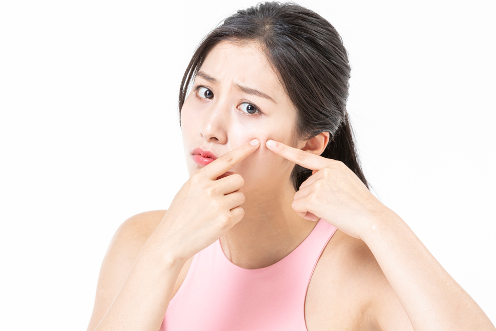 여드름 눈 밑 한관종 비립종 깨끗하게 없애는 법 아그네스 레이저 관련 이미지 1