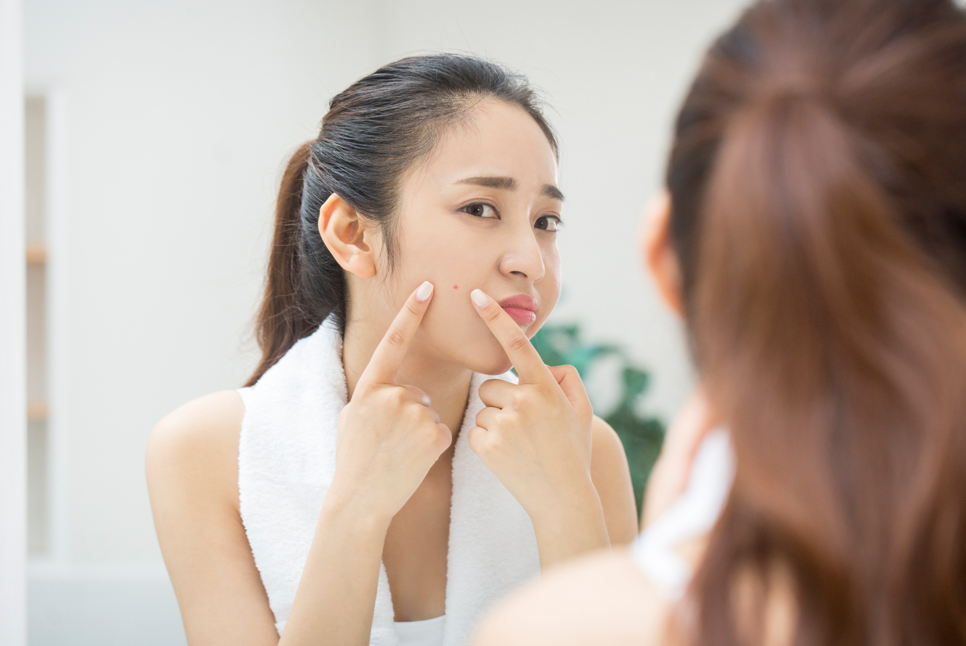 여드름에 직빵!! 여드름 자국 및 흉터 개선에 효과적인 스케일링 케어 관련 이미지 5