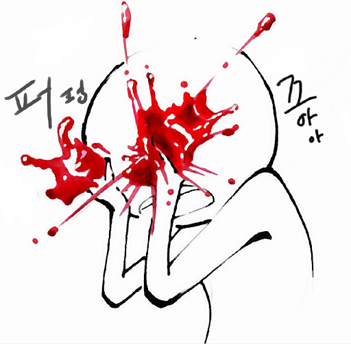 레이저 토닝 횟수, 사람마다 다르다? 관련 이미지 1