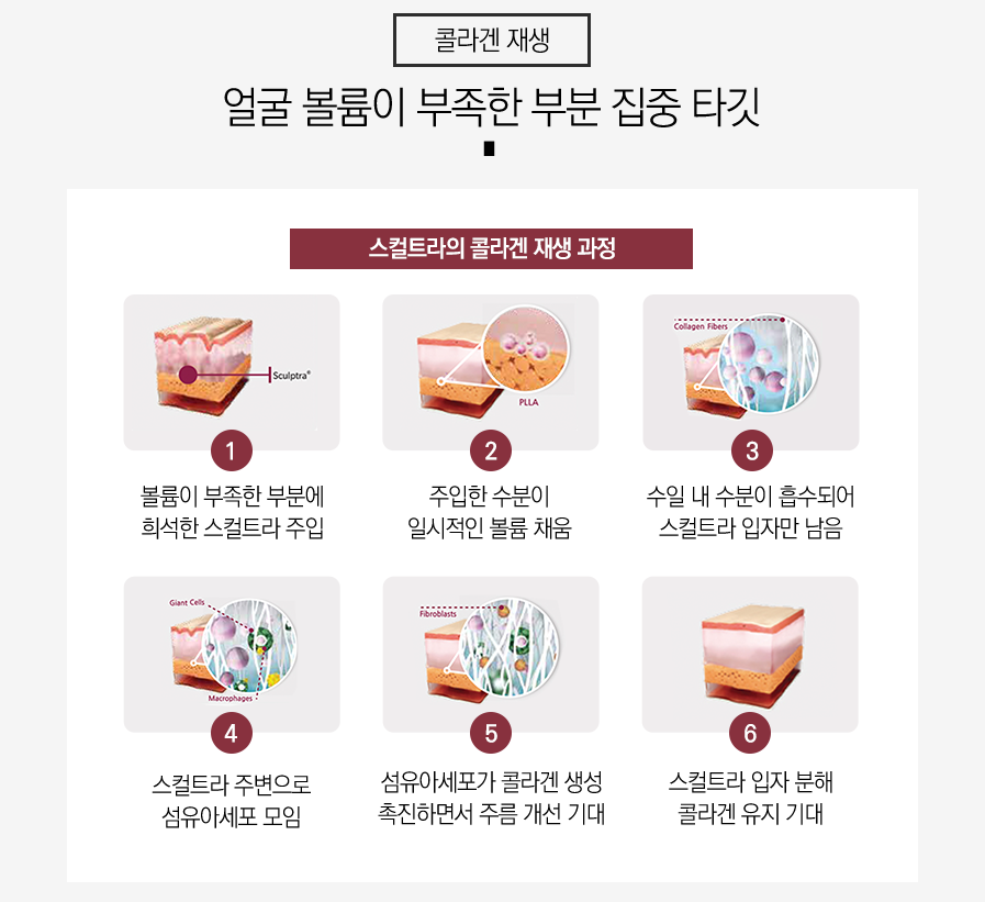 신림역피부과 볼륨 채우는 좋은 비법 관련 이미지 4