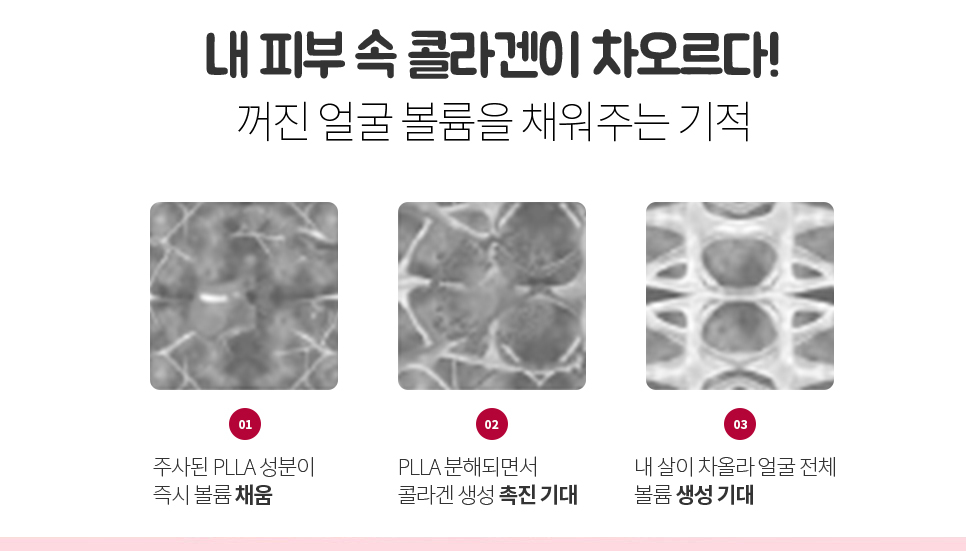 눈밑꺼짐 옆볼꺼짐 관련 이미지 3