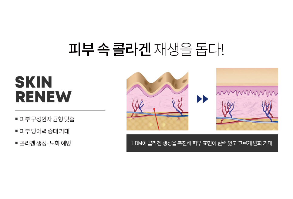LDM 물방울리프팅으로 피부에 촉촉함을 선사하자 관련 이미지 6